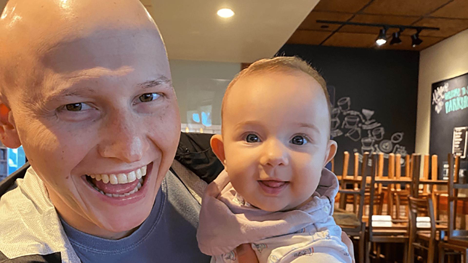 A bald young man holding a baby