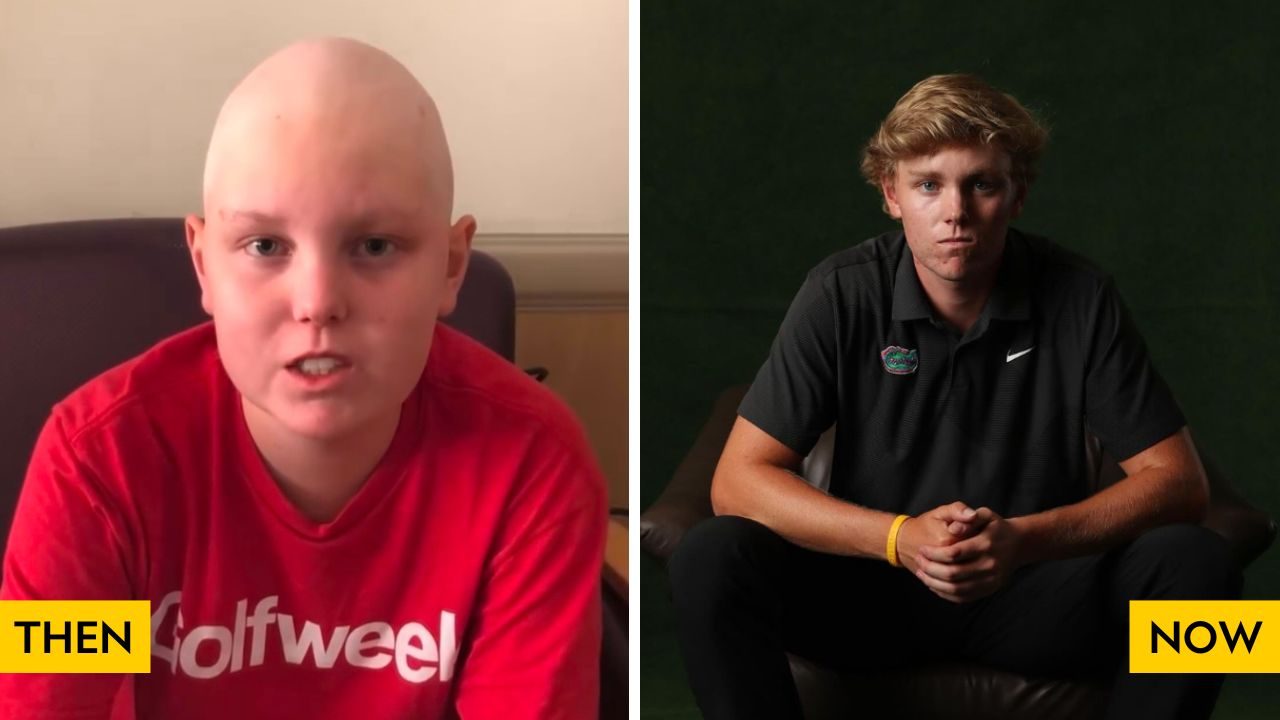 Then and now photos of a young man during and after cancer treatment