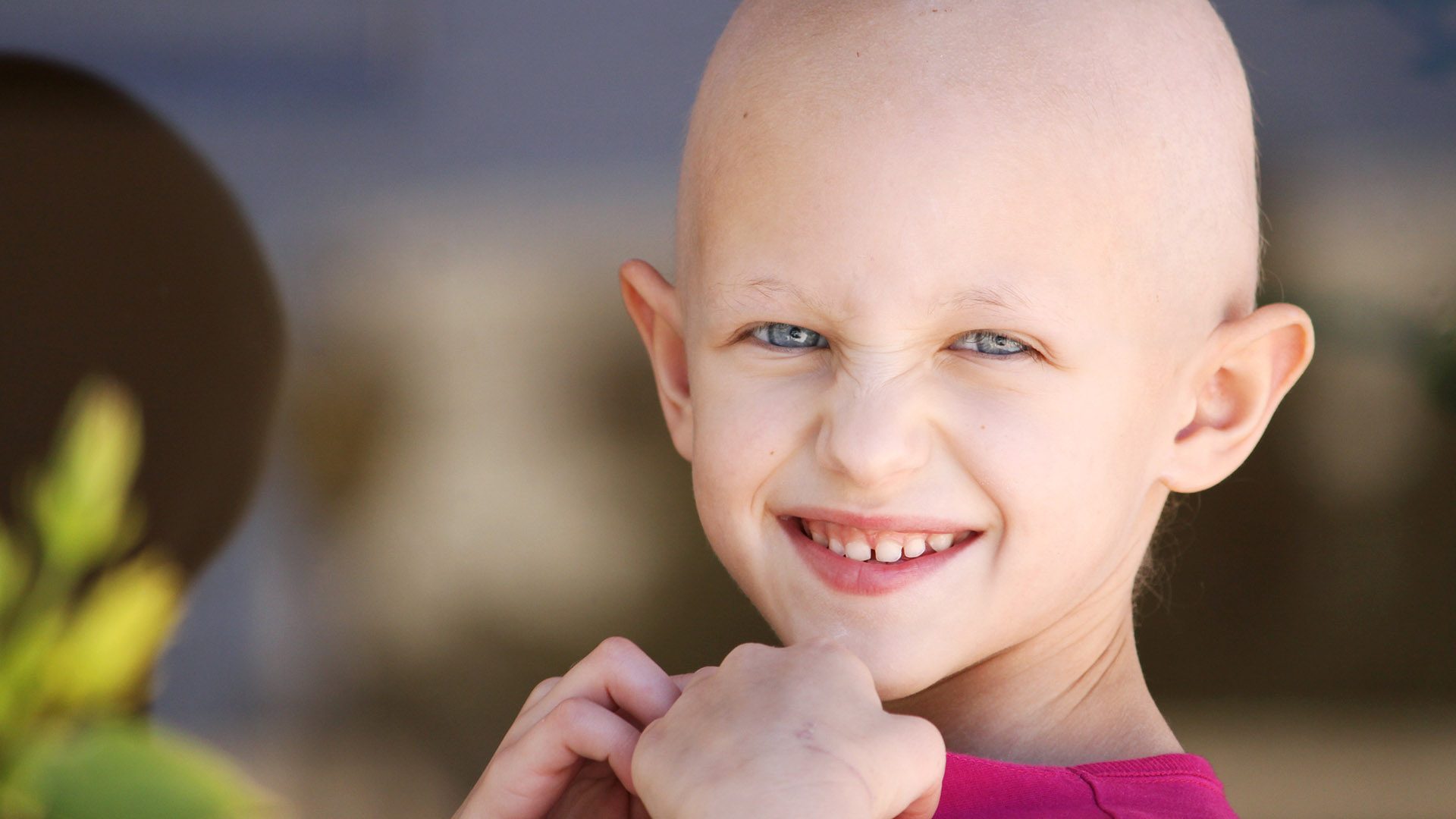Young girl with hair chemotherapy hair loss