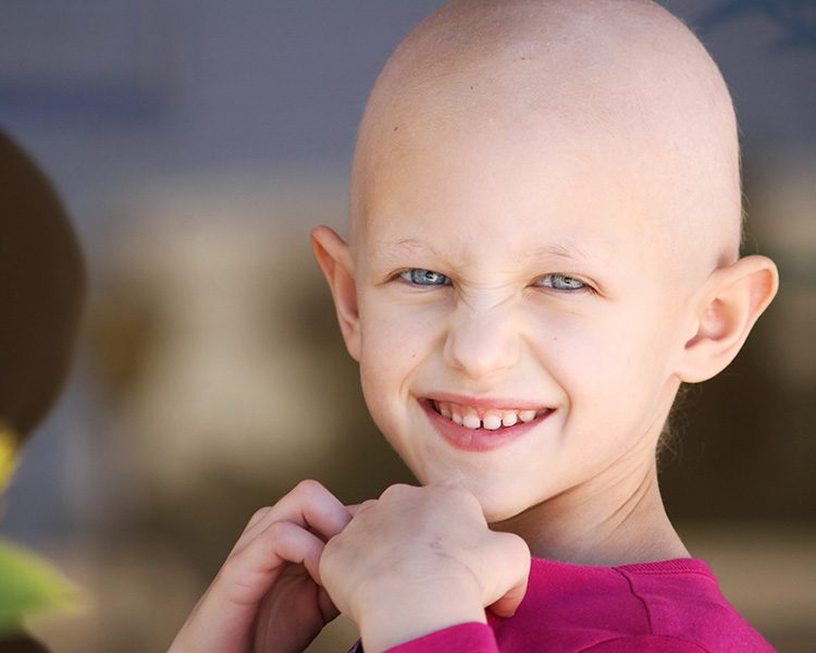 Young girl with hair chemotherapy hair loss